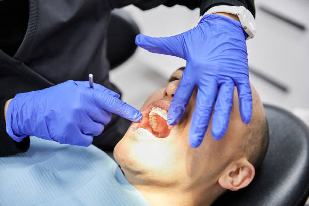 Best Emergency Treatment for Dental Infections or Abscesses in Vauxhall, NJ